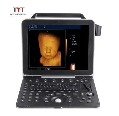 W2.0 Version Full-Digital Laptop Ultrasound Scanner Color Ultrasound Machine